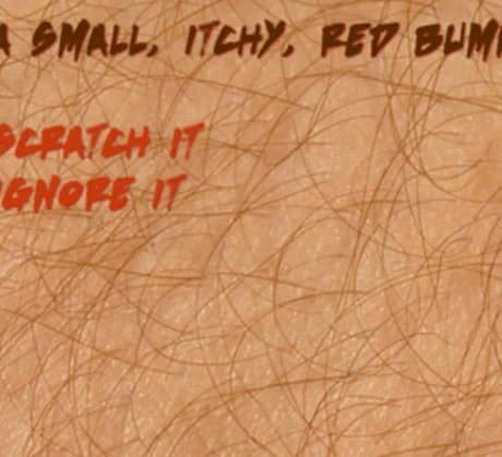 Itch
