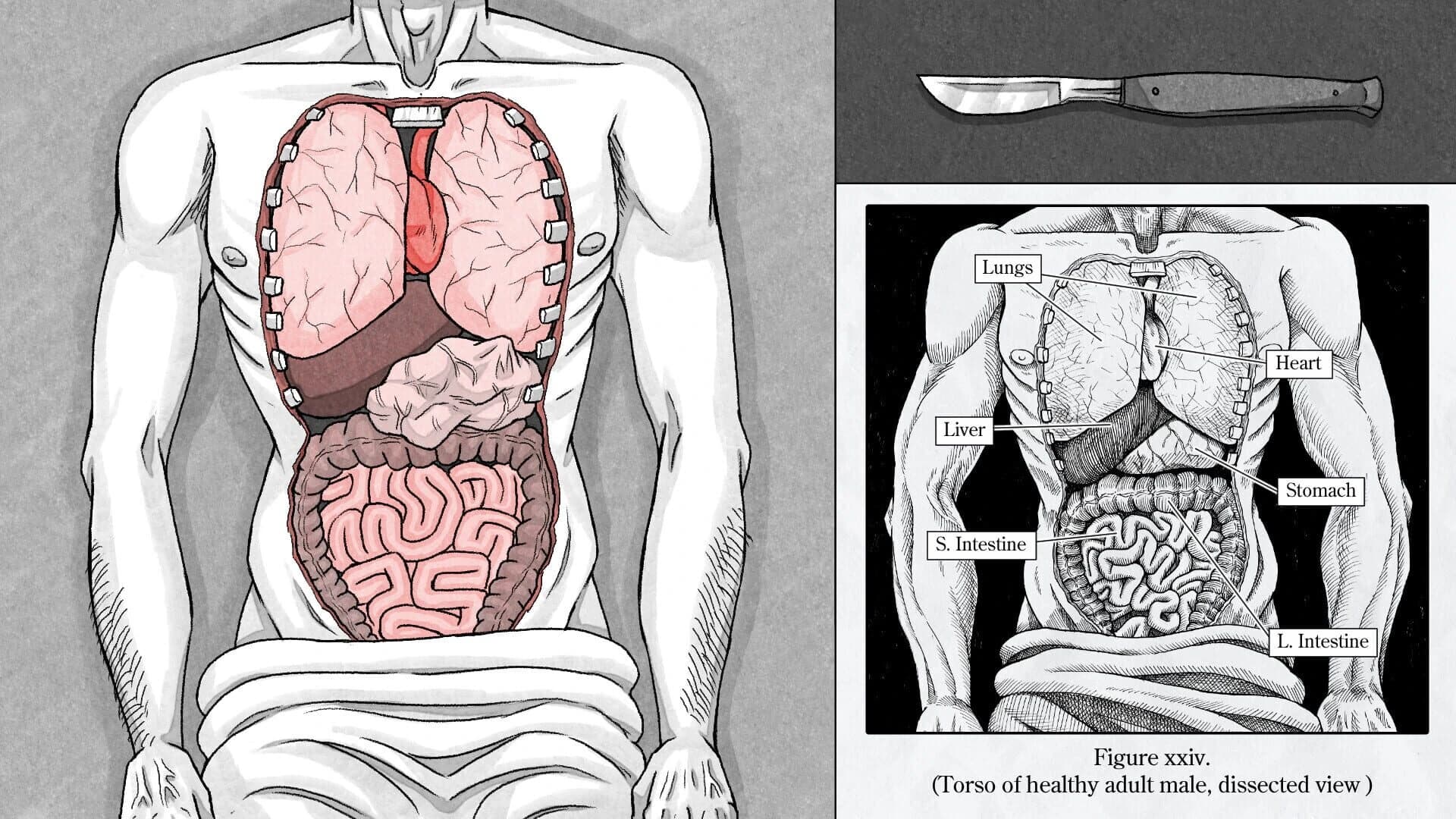 Edwin Earstwhile: Medical Examiner screenshot 3