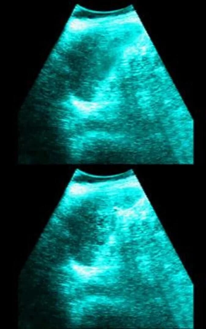 LifeSigns: Surgical Unit screenshot 1