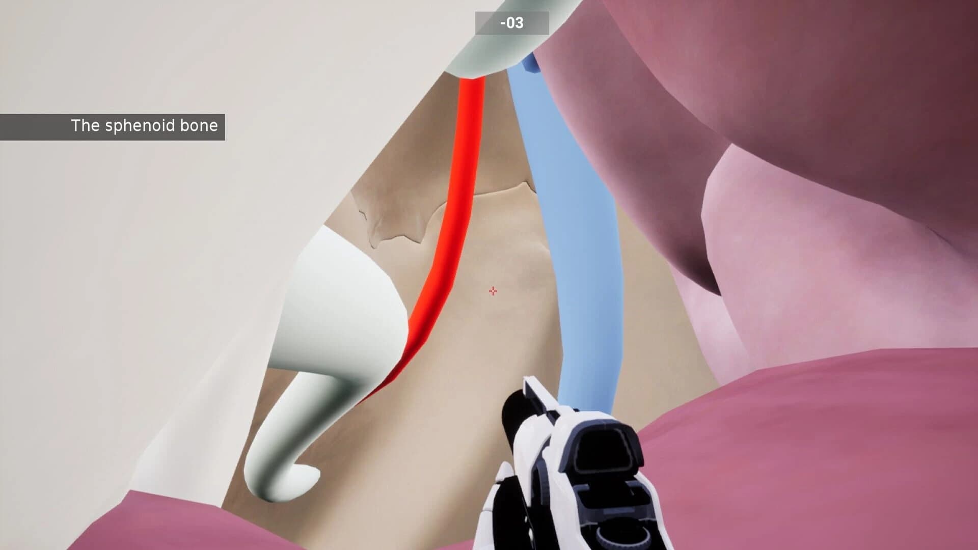 Shot the Body screenshot 5