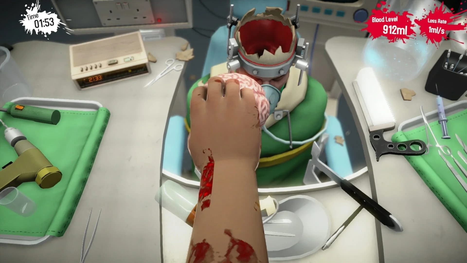 Surgeon Simulator: Anniversary Edition screenshot 4